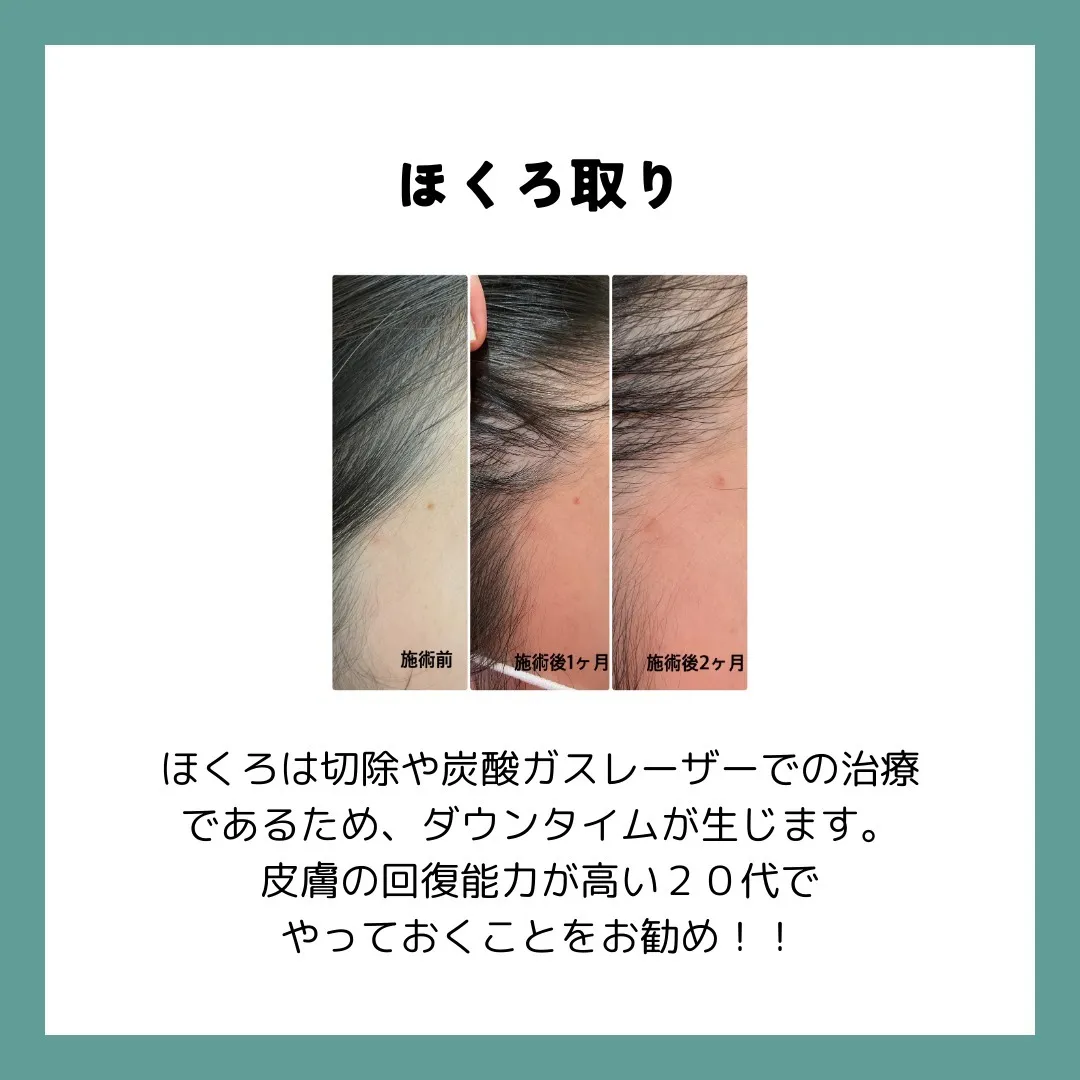 20代の皆さん、お肌の調子はいかがですか？若々しいこの時期に...