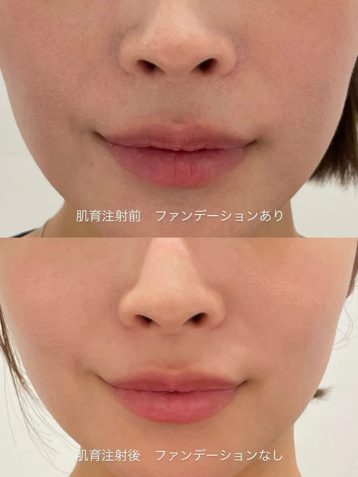 ＼新登場❕肌育メニュー✨／