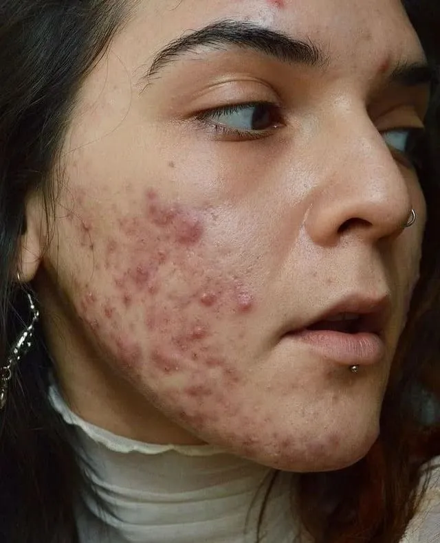 美容点滴・注射