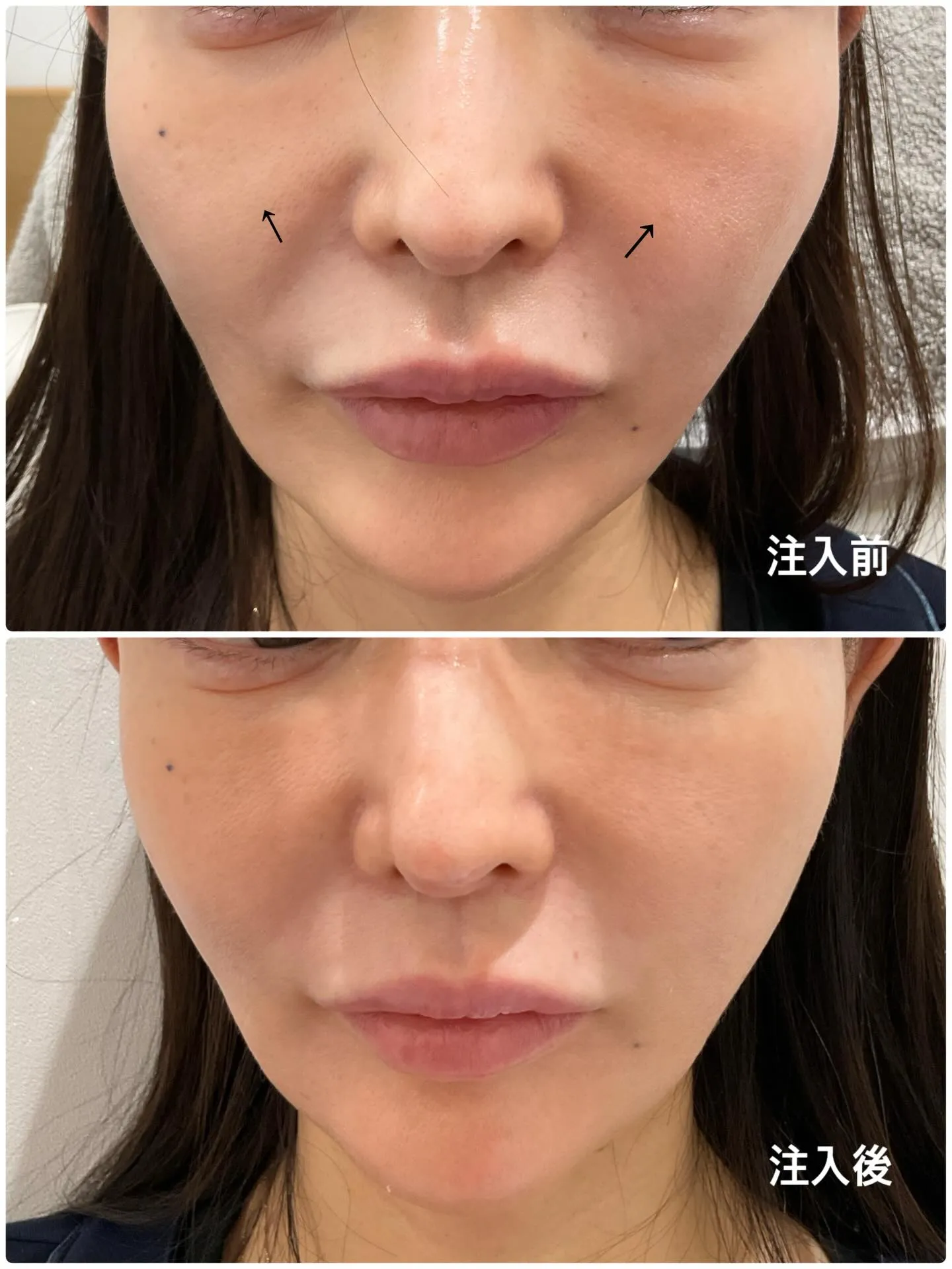 🌸「レスチレンリファイン」をご紹介します😊