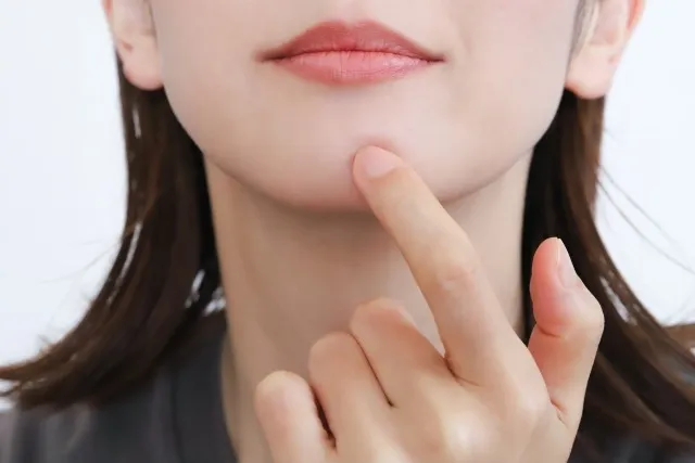 顎ニキビが治らないのはなぜ?繰り返す原因と悪化させないケア・皮膚科治療を解説