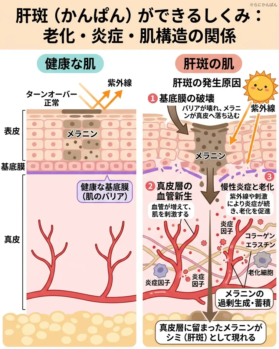 肝斑にお悩みですか？