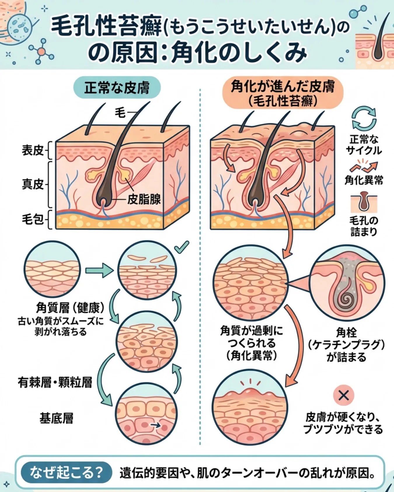 【二の腕のブツブツ、実は毛孔性苔癬かも💭】
