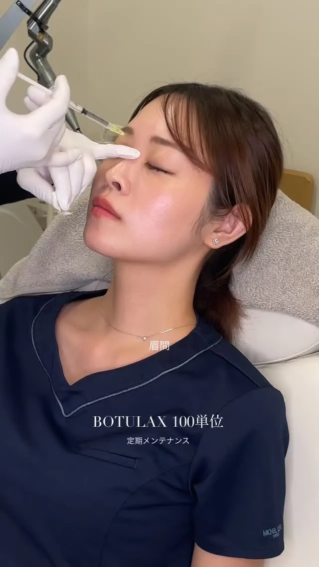 当院の看護師のボツラックス100単位の使い道です💭