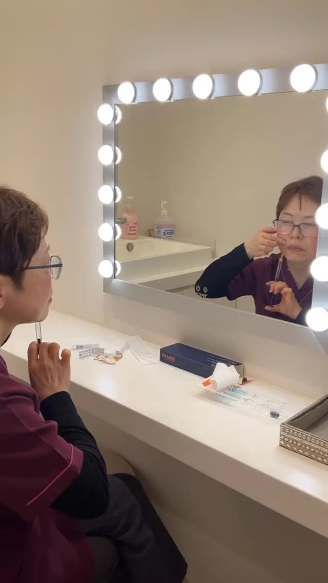 ほうれい線にレスチレンディファイン　0､4cc注入