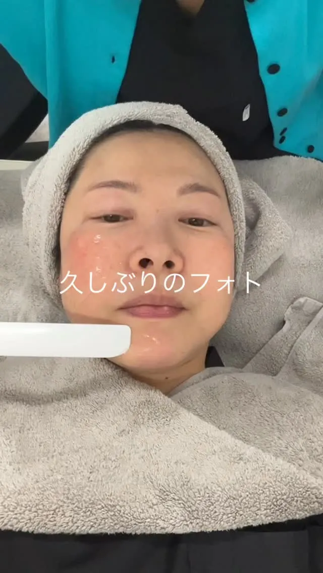 頬の赤みと色むらが気になったので，久しぶりにフォトフェイシャ...