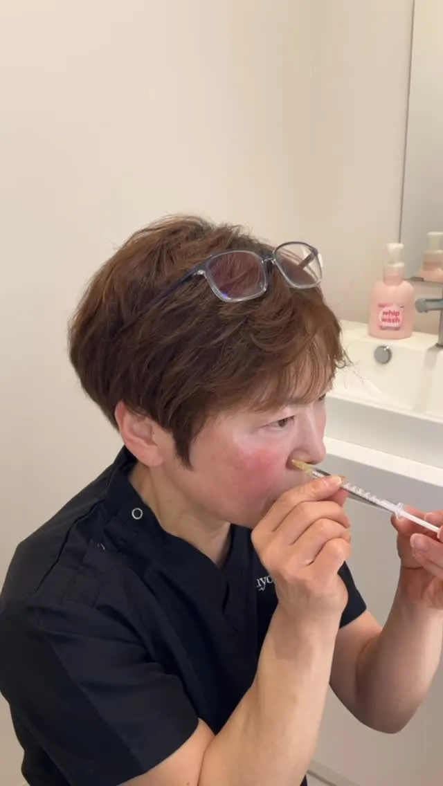 右の鼻の孔の広がりが気になり、右のみ上唇鼻翼挙筋と鼻筋にボト...